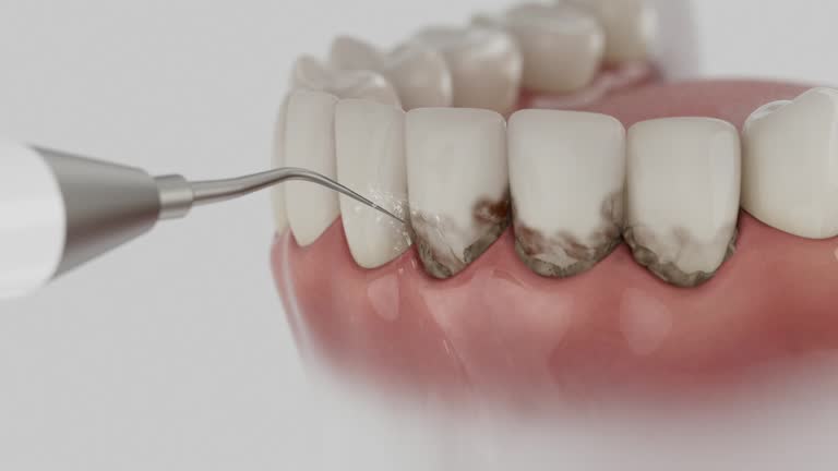 Trusted Root Canal Treatment service in Rock Hall, MD - Dentist Open Now
